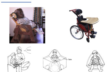 9 sự thật thú vị về Chứng Bại Não (CP)